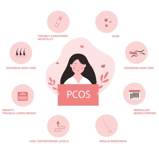 Common PMOS symptoms: irregular or missed periods, acne, excessive hair loss, excessive body hair, high testosterone levels, insulin resistance, trouble conceiving, and obesity or trouble losing weight